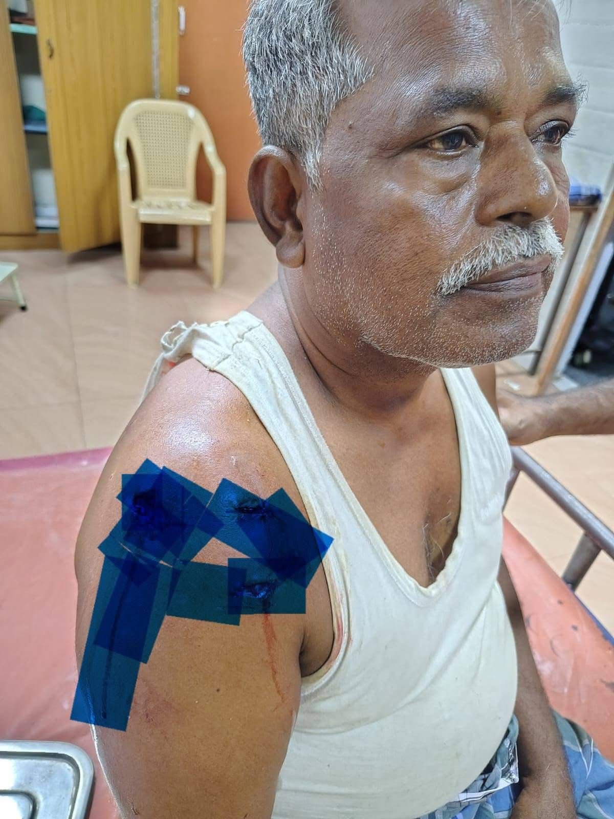 ஏலகிரி மலையின் 12வது வளைவில் இரு சக்கர வாகனத்தில் சென்ற ஒருவர் படுகாயமடைந்து மருத்துவமனையில் அனுமதிக்கப்பட்டார். வனத்துறை விசாரணை.