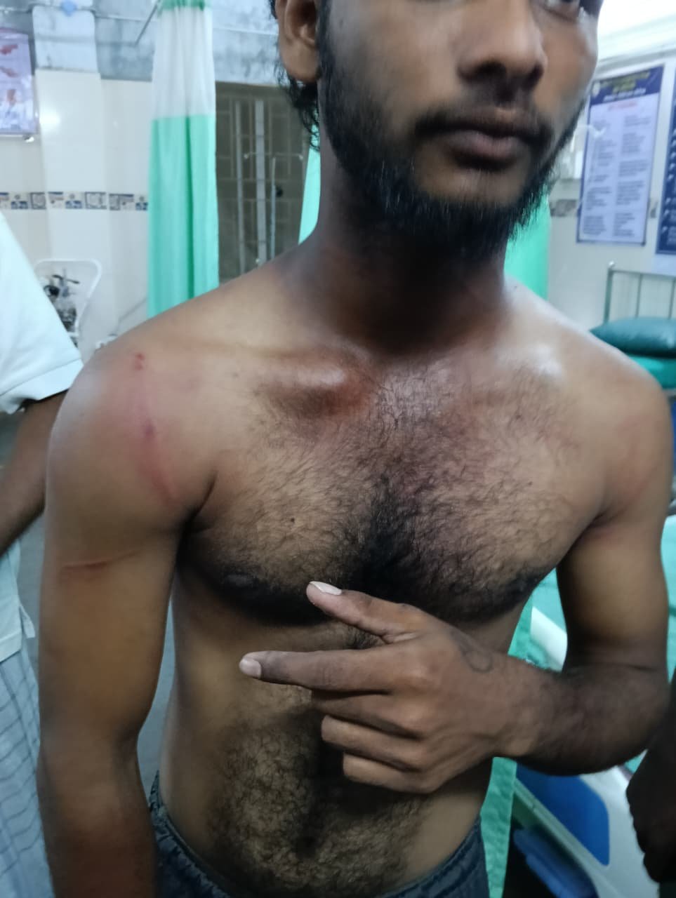 15 நபர்கள் சேர்ந்து கொடுரமாக அருவால் மற்றும் மரக்கட்டைகலாள் தாக்குதல் !